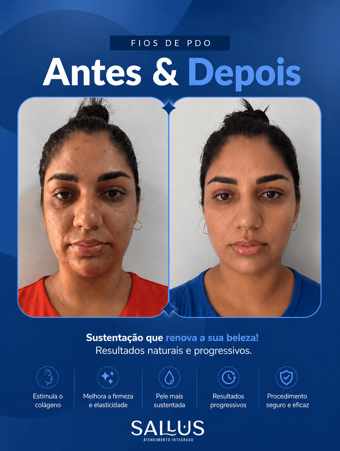 Antes e depois 01