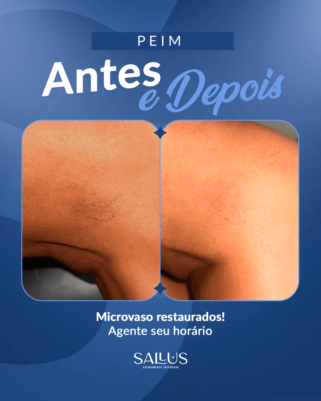Antes e depois 07
