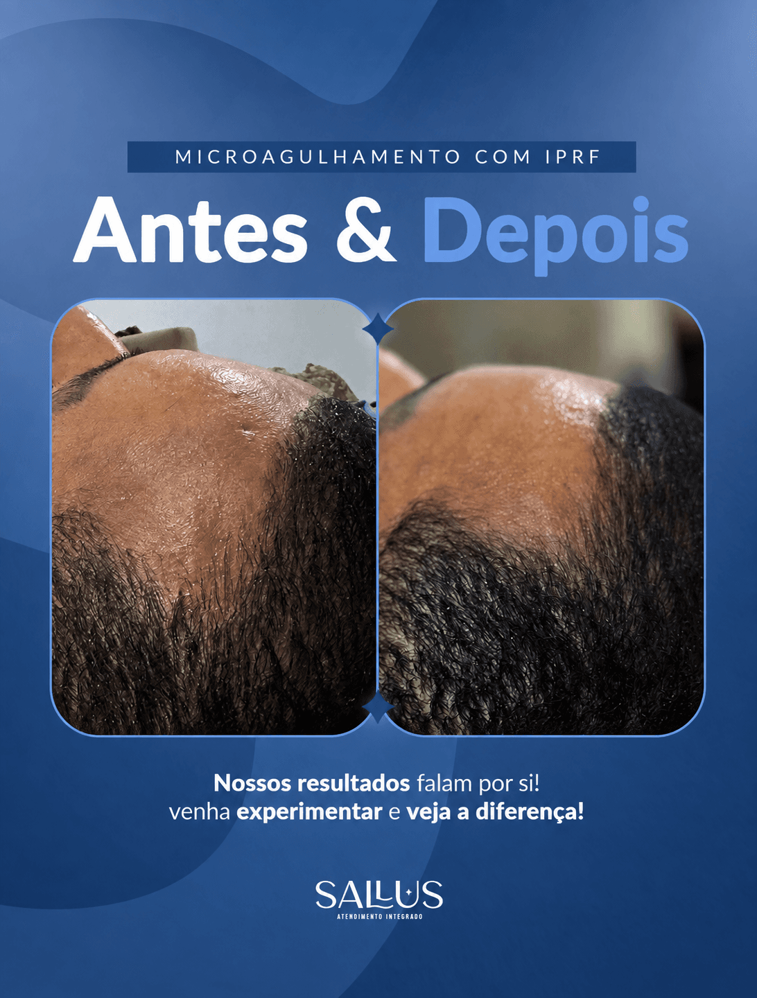 Antes e depois 09