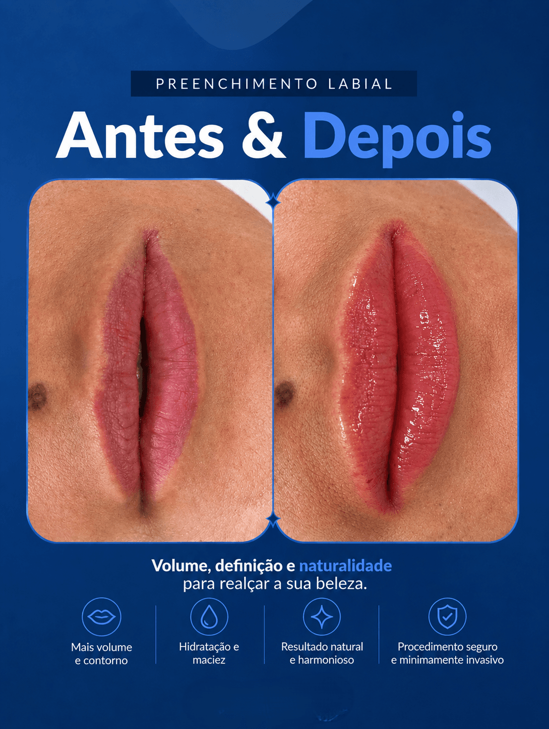 Antes e depois 12